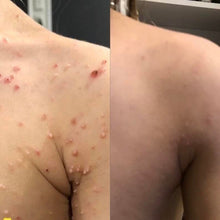 Load image into Gallery viewer, Mollumclear Starter Bundle